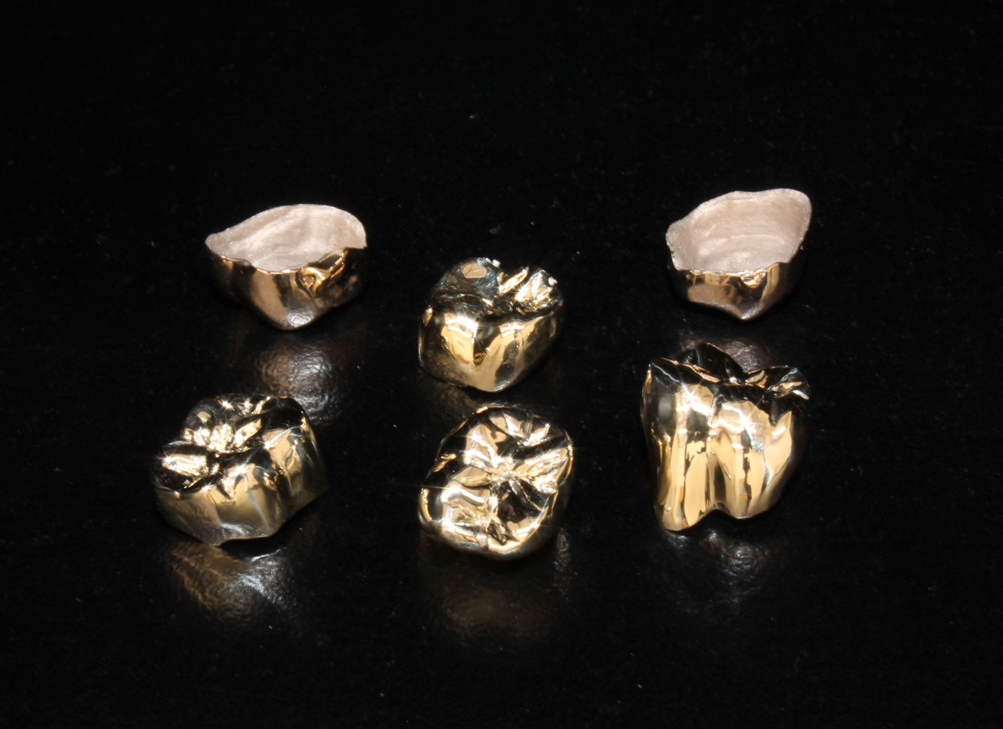 gold crowns