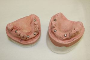 BCI Dental Implants